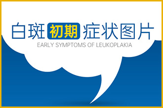 到底是不是白颠疯诊断起来容易吗