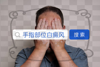 李崇英医师为你解答晚期白癜风存在的危害都有那些