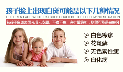 小孩脸上有白斑怎么办?