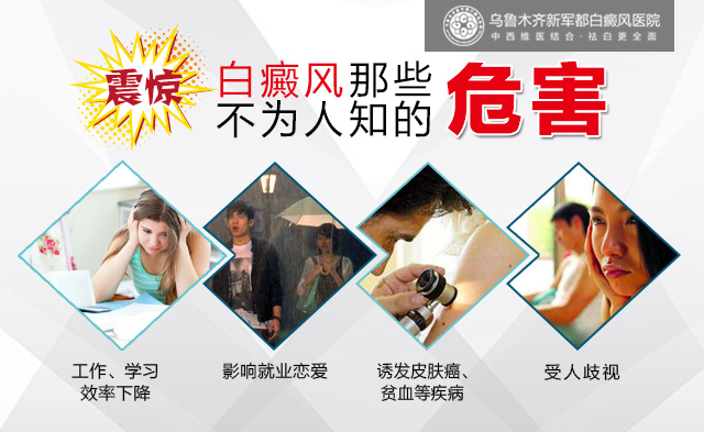 白癜风哪些不为人知的危害.jpg 白癜风的危害有哪些?