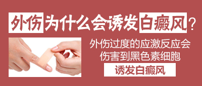 1477560099111706.jpg 皮肤出现白斑的原因是什么?